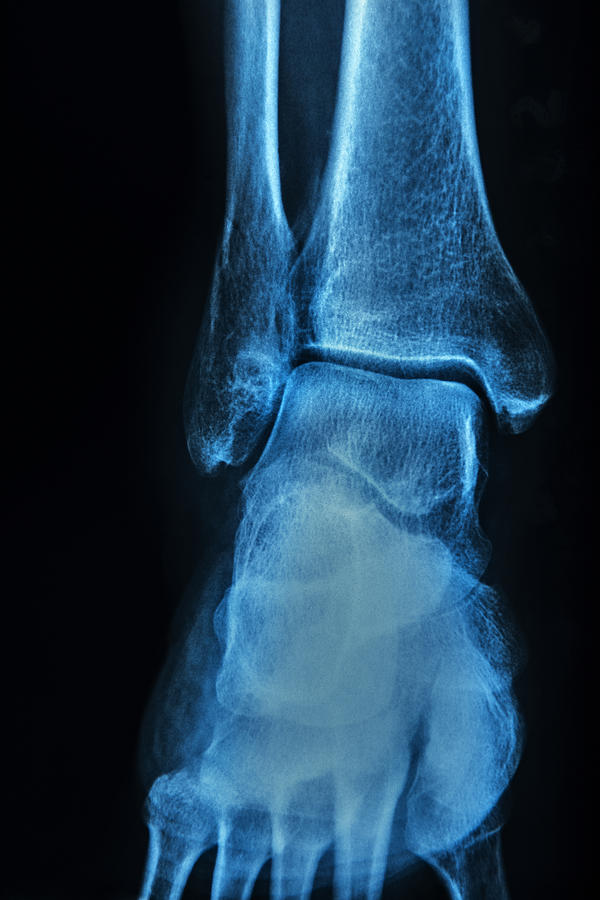 Human ankle Photograph by Georg Hanf