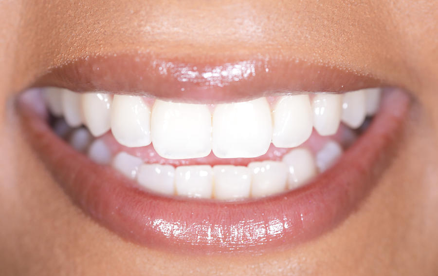 Human smile, white teeth Photograph by Peter Cade