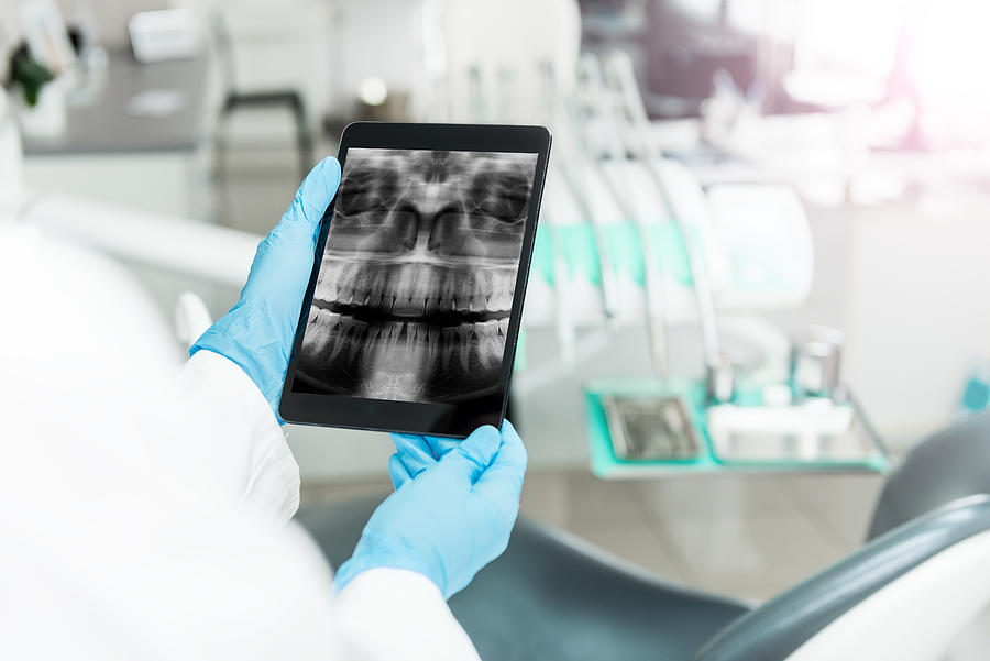 Human teeth x-ray on the tablet Photograph by Yoh4nn