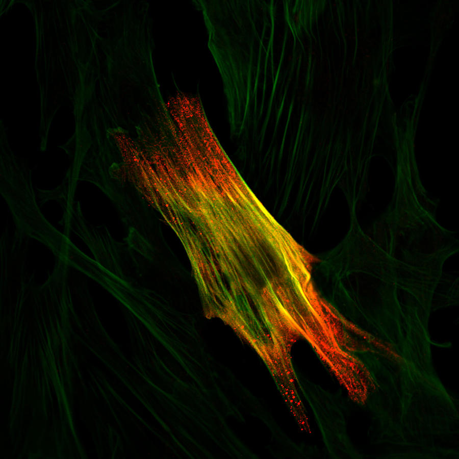 Immunoflourescence of a smooth muscle cell Photograph by Beano5