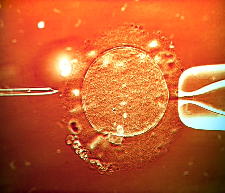 IVF treatment sperm being injected into human egg Photograph by Science Photo Library - ZEPHYR.