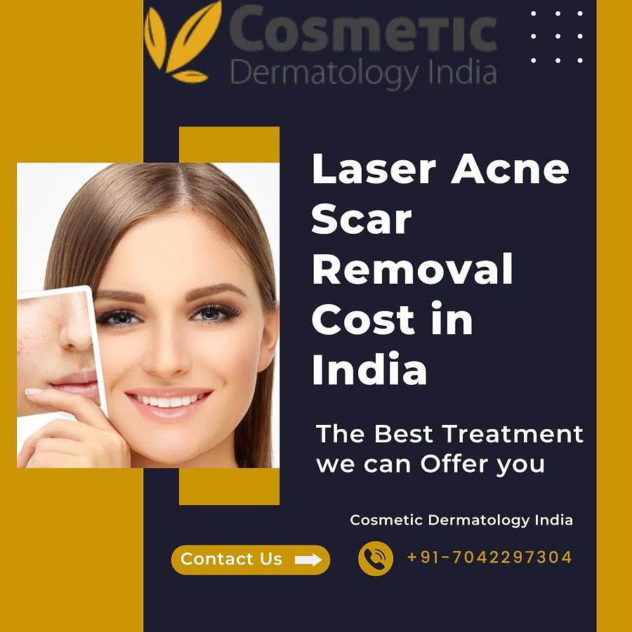 Laser Acne Scar Removal Cost in India Digital Art by Cosmetic