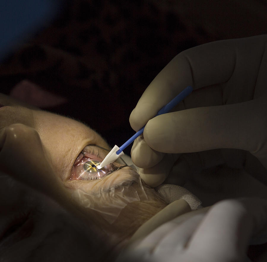 Laser eye surgery Photograph by Arctic-Images