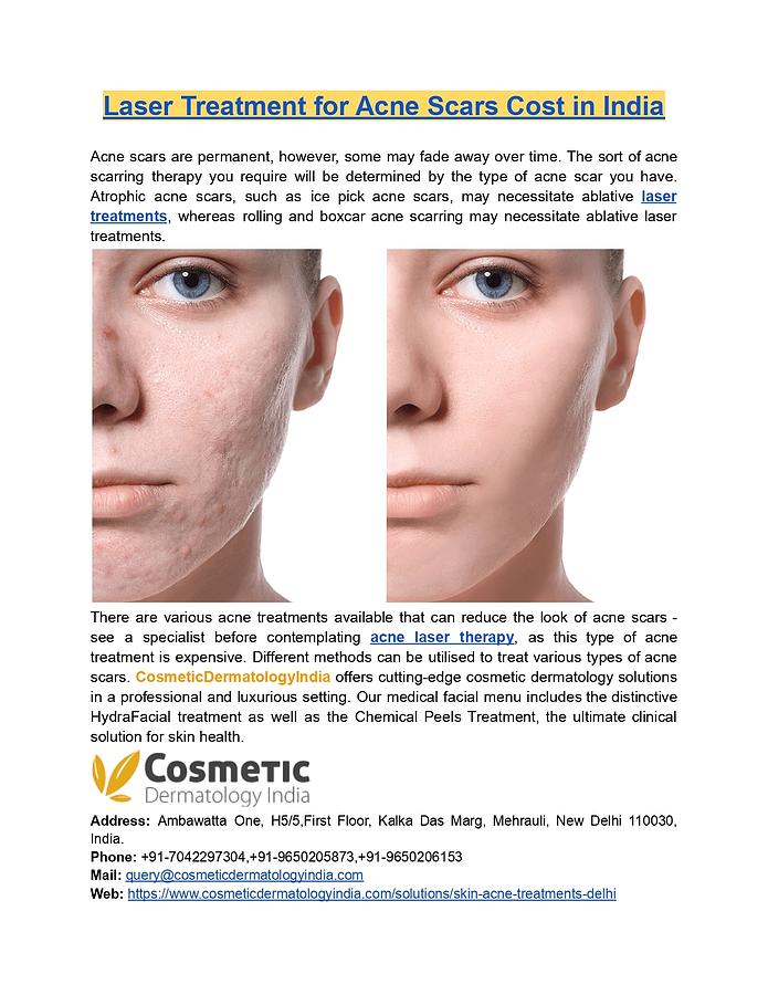 Laser Treatment For Acne Scars Cost In Indore