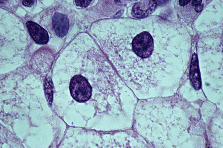 LIVER CELLS, EUKARYOTIC CELL, 250X. Shows: nucleus, cytoplasm, plasma membrane. Amphiuma (salamander, siren) Photograph by Ed Reschke