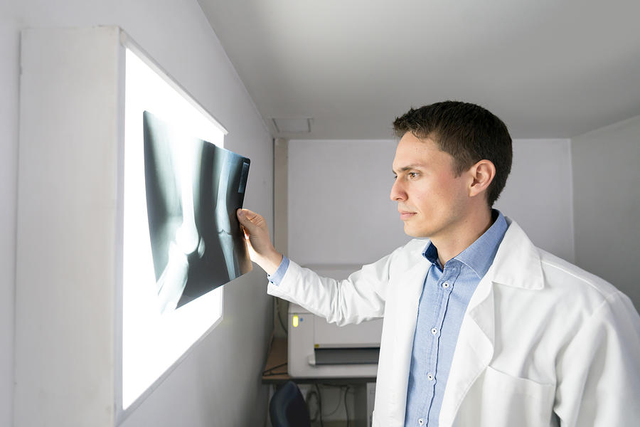 Male orthopedist looking at an xray looking concerned Photograph by Andresr