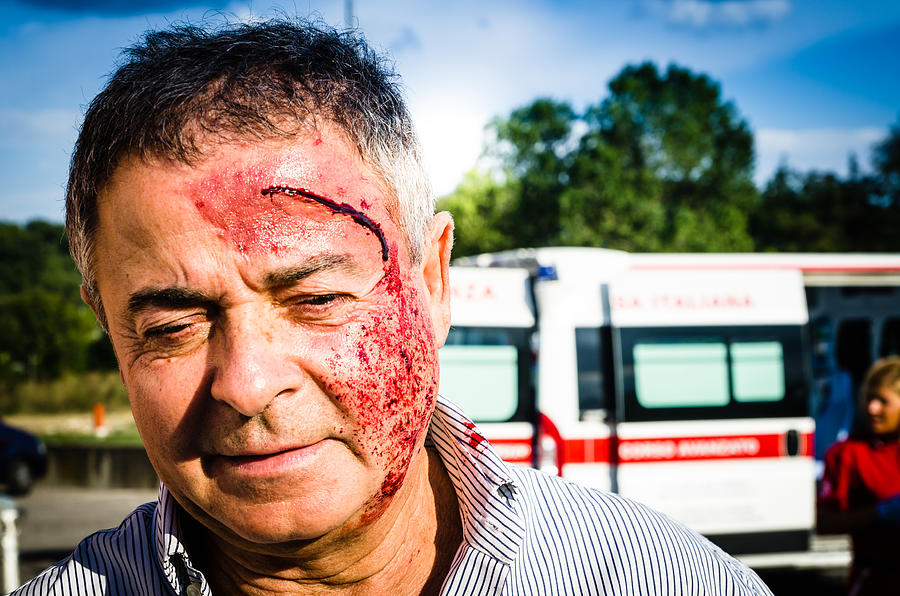 Man face after car accident Photograph by FilippoBacci