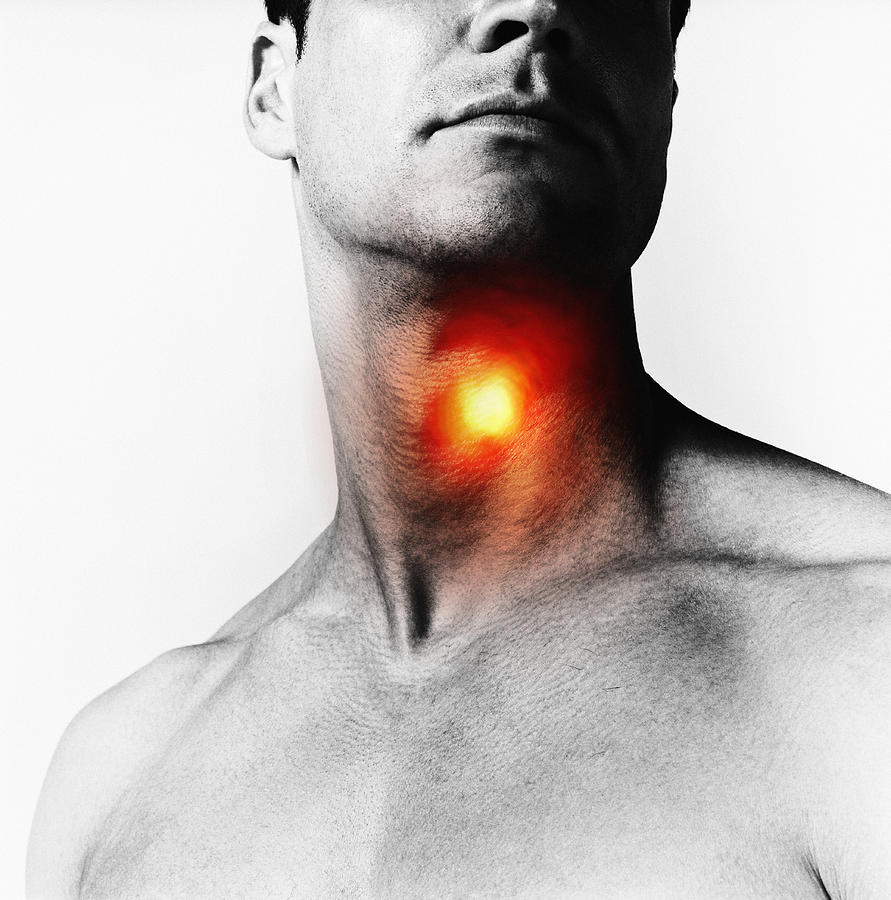 Man with heat spot over throat, close-up (Digital Composite) Photograph by Adam Gault