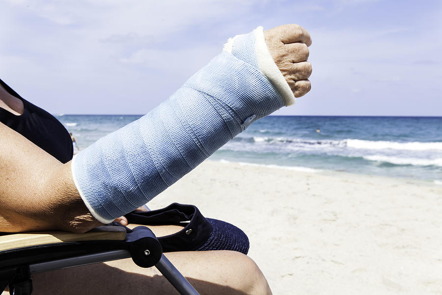 Medical: Broken arm in the summer Photograph by JodiJacobson