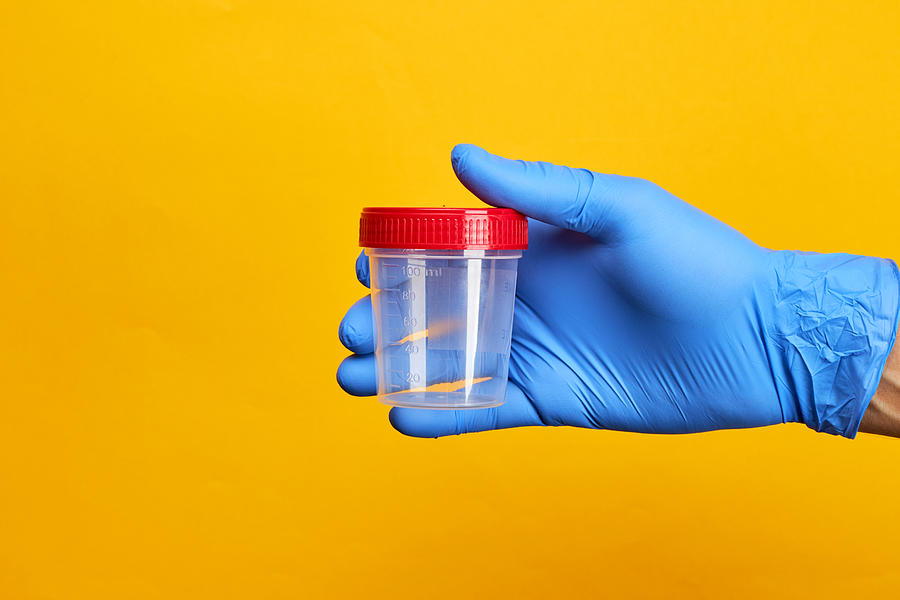 Medical Exam Concept. Person Holds Urine Test Cup Over Bright Yellow Background. Photograph by Andrii Atanov