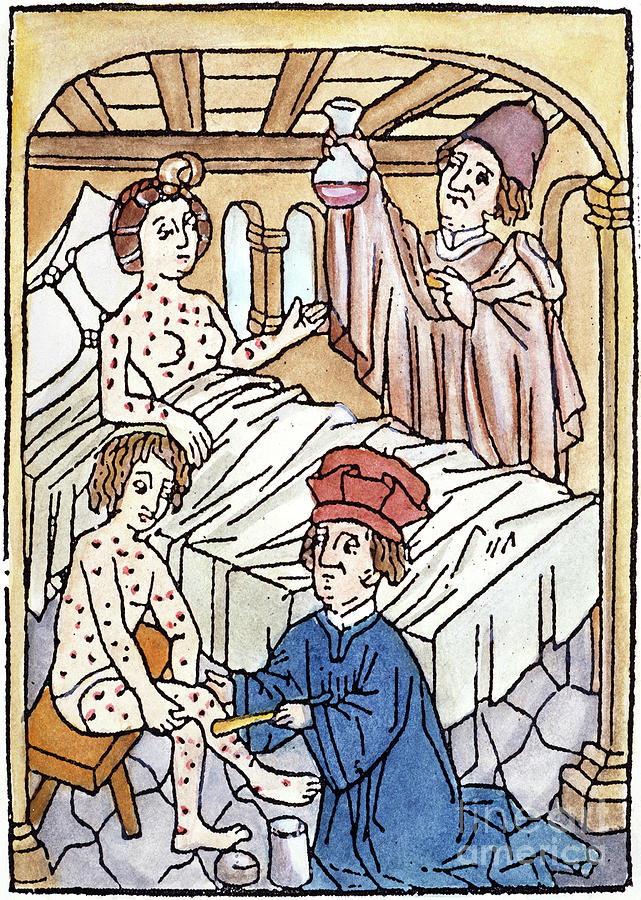 Medieval Syphilis, 1497 Photograph by Granger