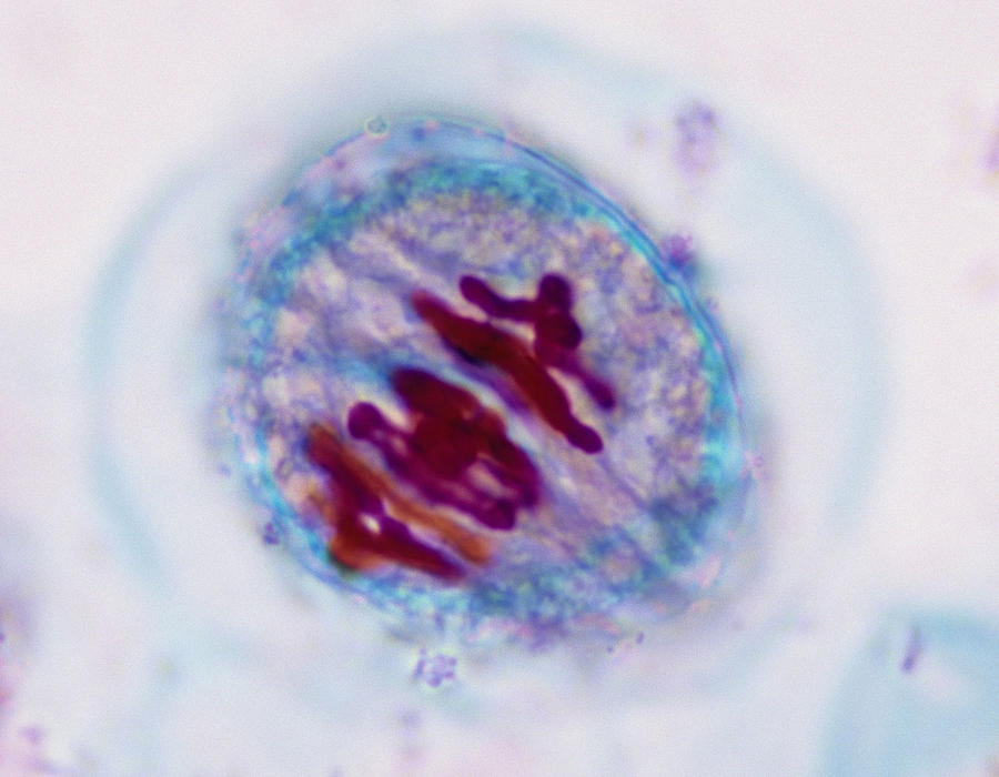 MEIOSIS 1, METAPHASE 1 (1st Division), Lilium (Lily), 400X at 35mm Photograph by Ed Reschke