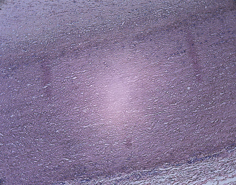 Microscopic Image of a Coronary Artery Photograph by Duncan Smith