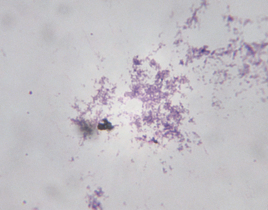 Microscopic Image of Borrelia Burgdorferi Photograph by Duncan Smith