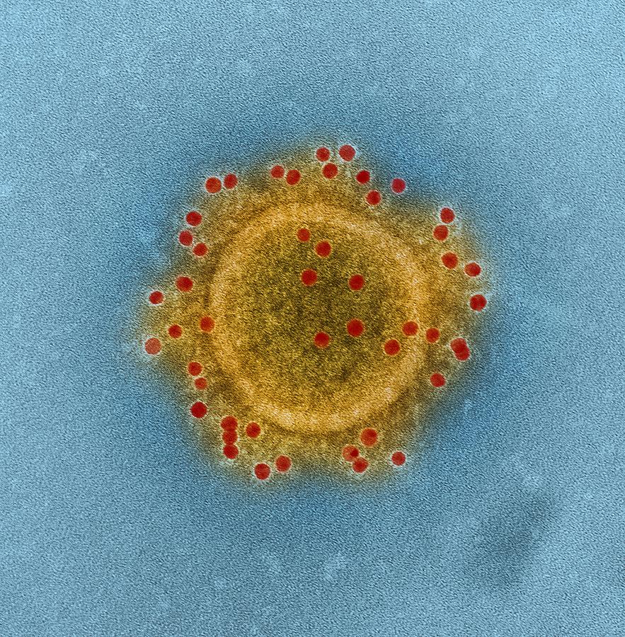Middle East Respiratory Syndrome Coronavirus particle envelope proteins immunolabeled with Rabbit HCoV-EMC/2012 primary antibody and Goat anti-Rabbit 10 nm gold particles Photograph by Callista Images