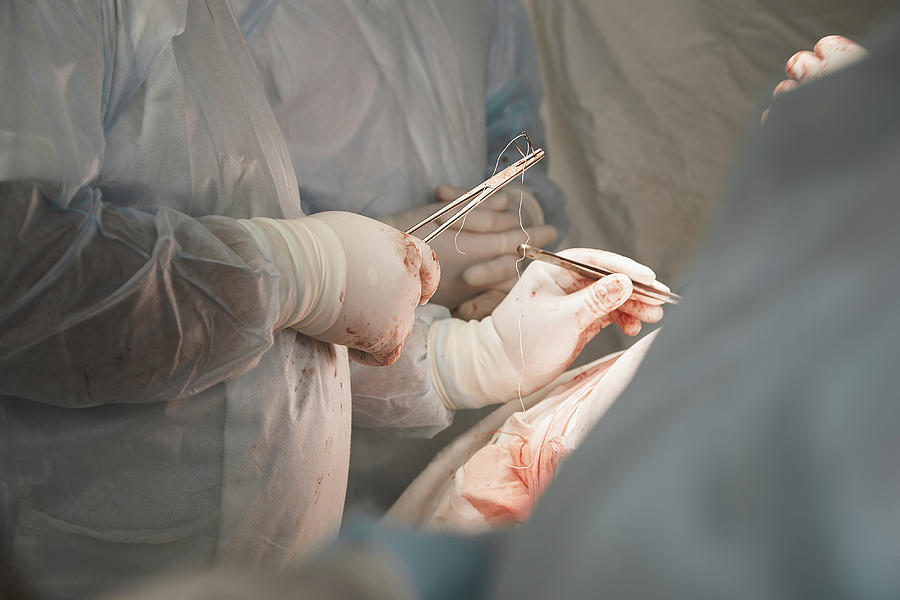 Midsection of medical team performing surgery in operating room Photograph by Alexandr Sherstobitov