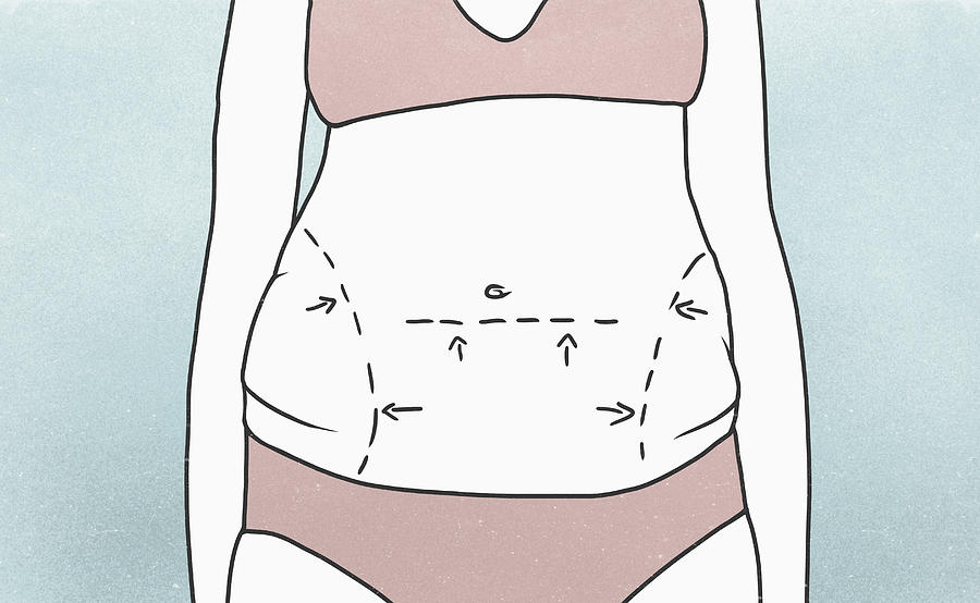 Midsection of woman with marked outlines on abdomen Drawing by Malte Mueller