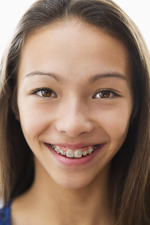 Mixed race girl smiling with braces Photograph by Don Mason