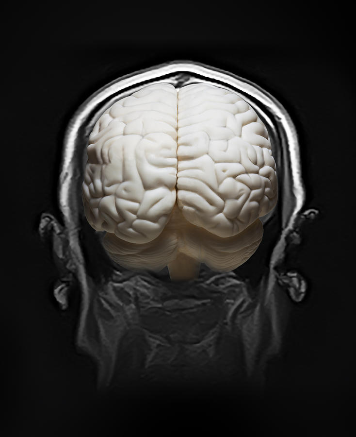 MRI and model of human brain Photograph by Yuji Sakai