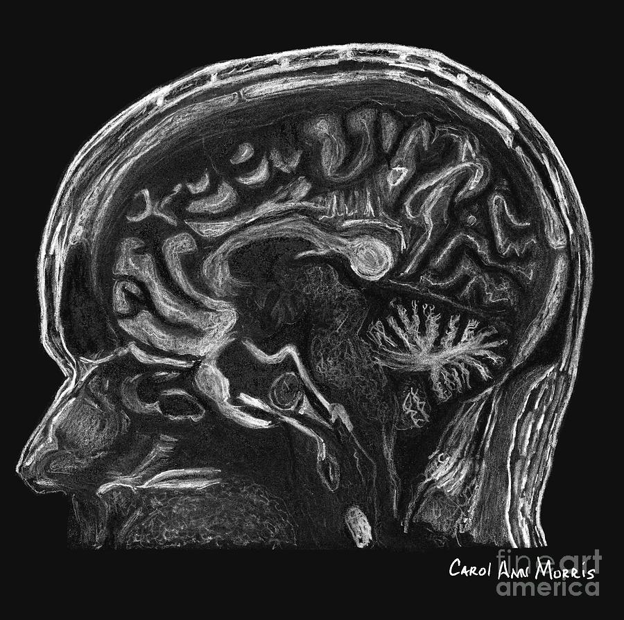 MRI Brain Drawing by Carol Morris