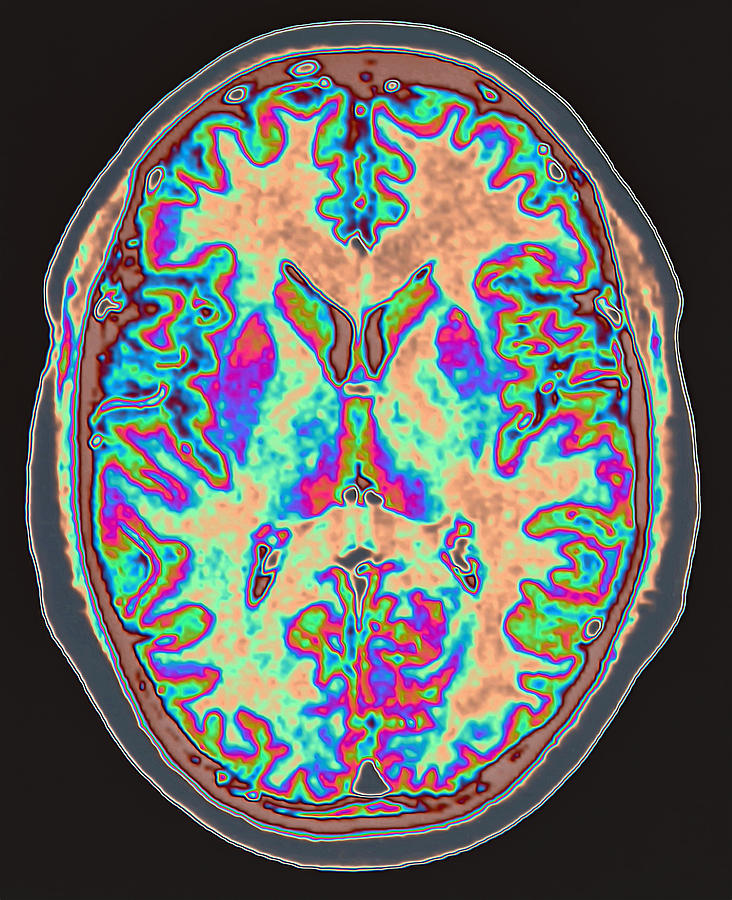 MRI scan of brain Photograph by Image Source