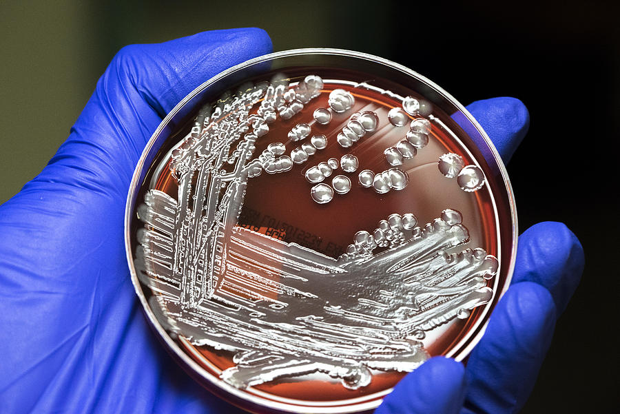 Multi-resistant E. coli bacteria Photograph by Rodolfo Parulan Jr