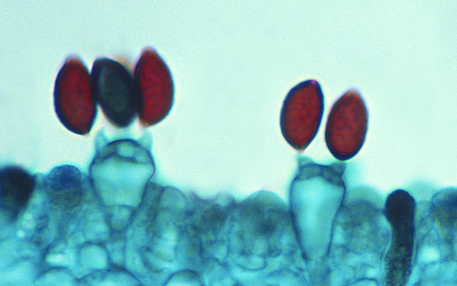 Mushroom Spores--Basidiospores and Basidium, 250X Photograph by Ed Reschke