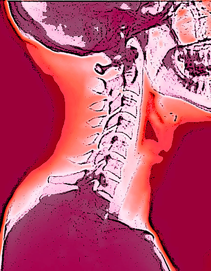 Neck Digital Art by Chris taggart - Pixels