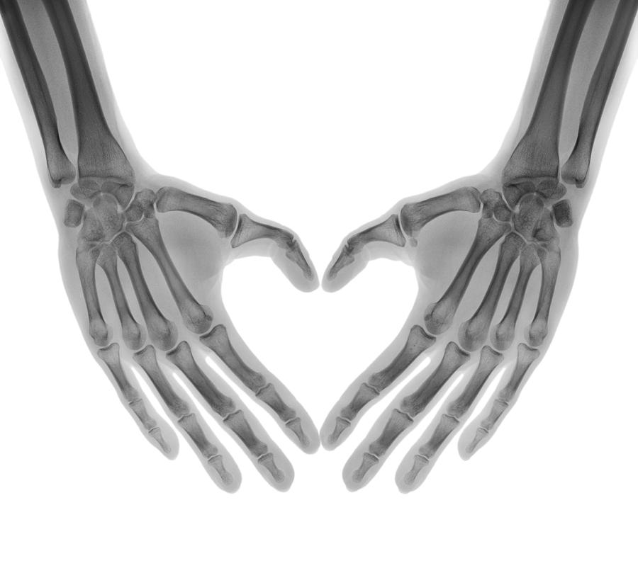 Negative X-ray - Human palms folded in a heart shape Photograph by Trout55
