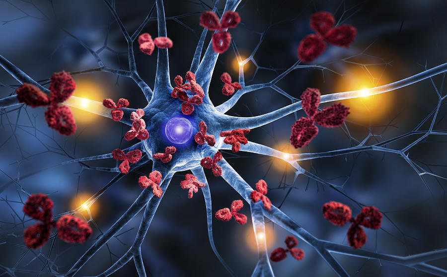 Nerve cell attacked by Antibodies Photograph by Peterschreiber.media Nerve cell attacked by Antibodies Photograph by Peterschreiber.media