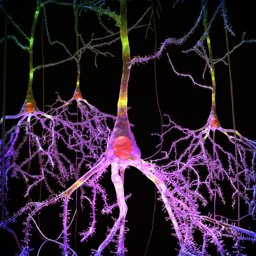 Neurons Purple and Yellow Digital Art by Russell Kightley
