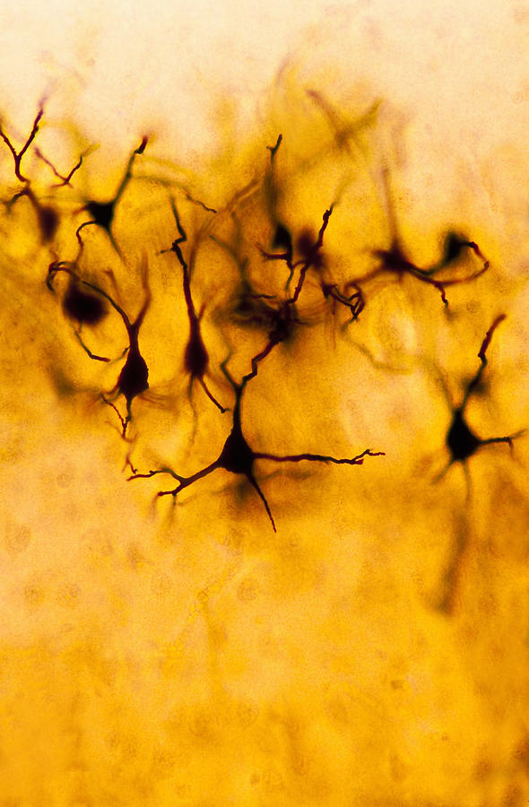 Neurons (Pyramidal Cells), Cerebral Cortex (Magnification x100) Shows: neurons, cell bodies, and numerous nerve fibres that are mostly dendrites. Fox-Golgi stain. Photograph by Ed Reschke