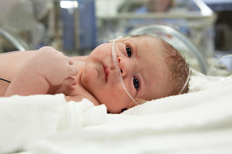 Newborn baby with IV wires and hospital in the background Photograph by Garymilner
