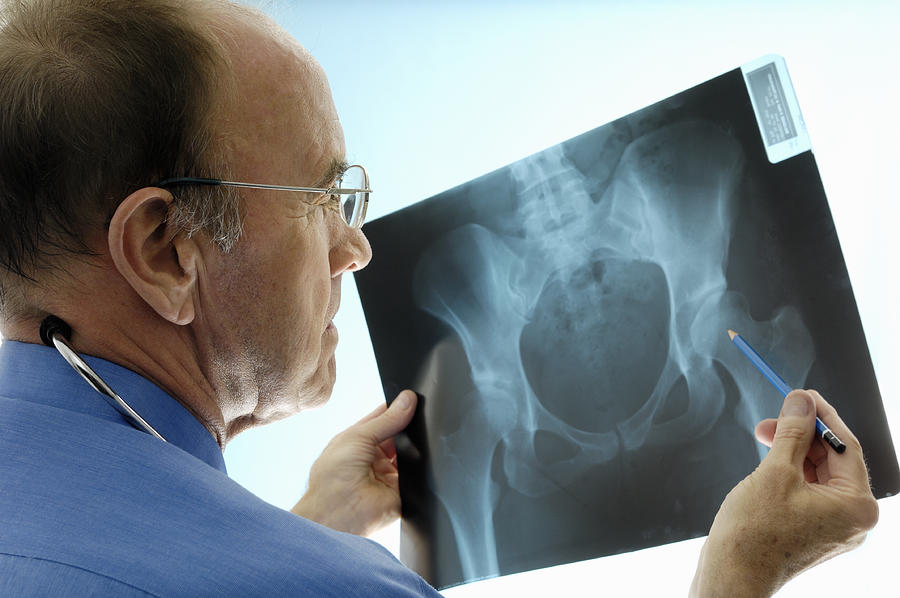 Orthopaedic surgeon consulting pelvic x-rays for a hip replacement. Photograph by Fertnig