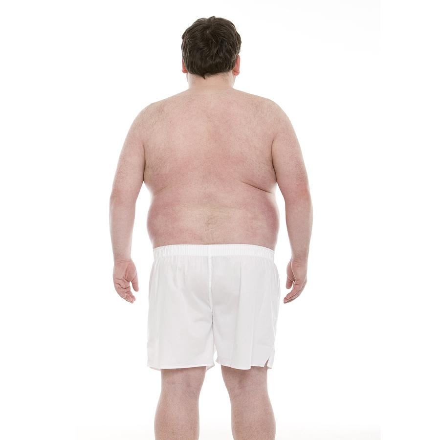 Overweight man Photograph by Science Photo Library