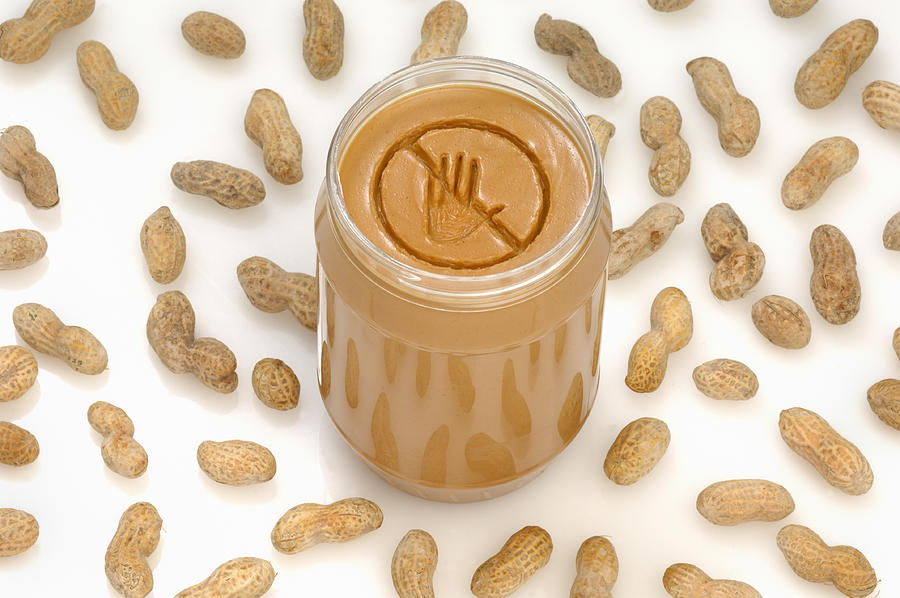 Peanut allergy Photograph by Fertnig