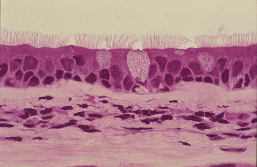 Photomicrograph of pseudostratified ciliated columnar epithelium of the trachea with goblet cells; 100X. Photograph by Ed Reschke