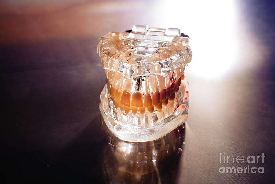 Plastic Mold Of A Jaw With Teeth, On A Dentists Stainless Table Photograph