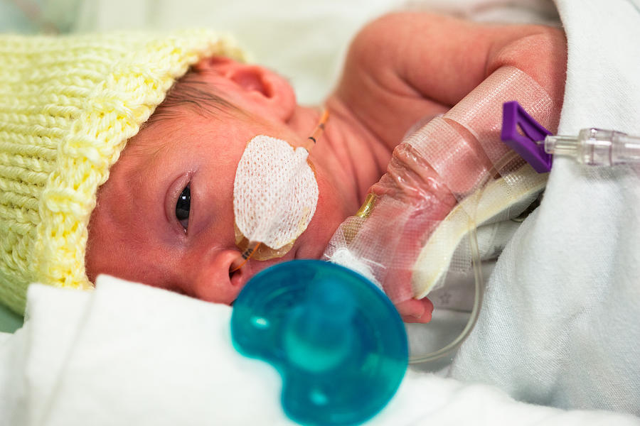 Premature baby in the neonatal intensive care unit with a pacifier Photograph by AWelshLad