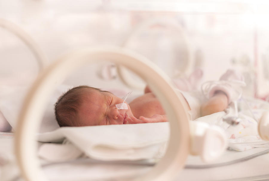 Premature newborn  baby girl Photograph by Ondrooo