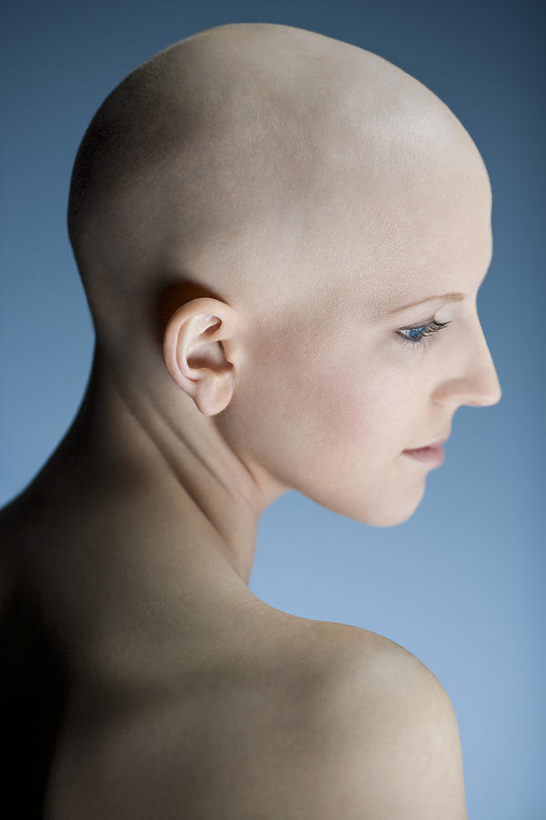 Profile of a bald young woman thinking Photograph by Rubberball