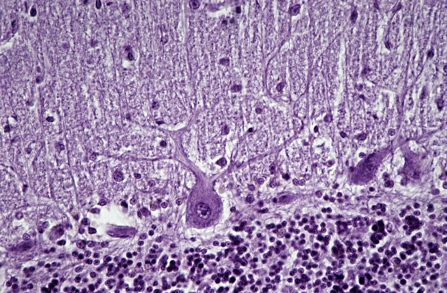 Purkinje cell (neuron); cerebellum, 100X at 35mm. Shows: cell body, nucleus, nucleolus, and branching dendrites. Human cerebellum. Photograph by Ed Reschke