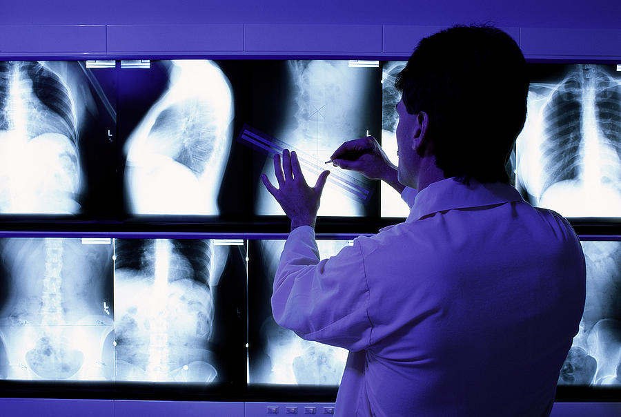 Radiologist Examining X-rays On Light Box Photograph by Harry Sieplinga/HMS Images