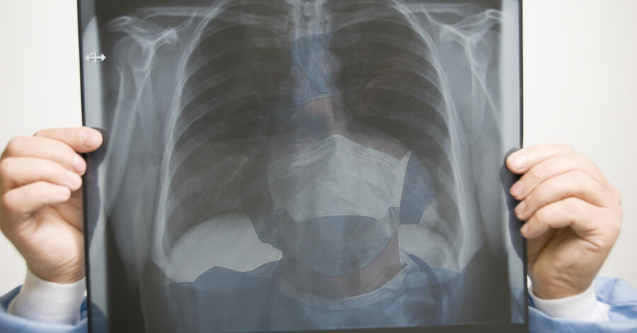 Radiologist looking at chest x-ray Photograph by Mehmed Zelkovic
