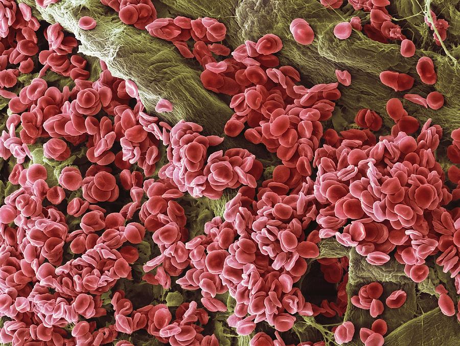 Red blood cells, SEM Photograph by Steve Gschmeissner/spl