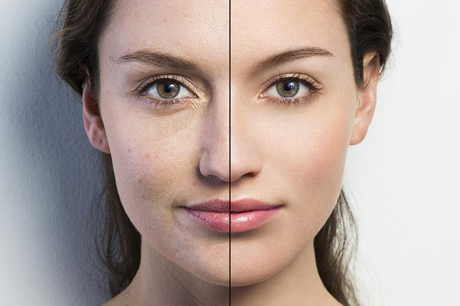 Retouched face vs natural face close-up Photograph by Dimitri Otis