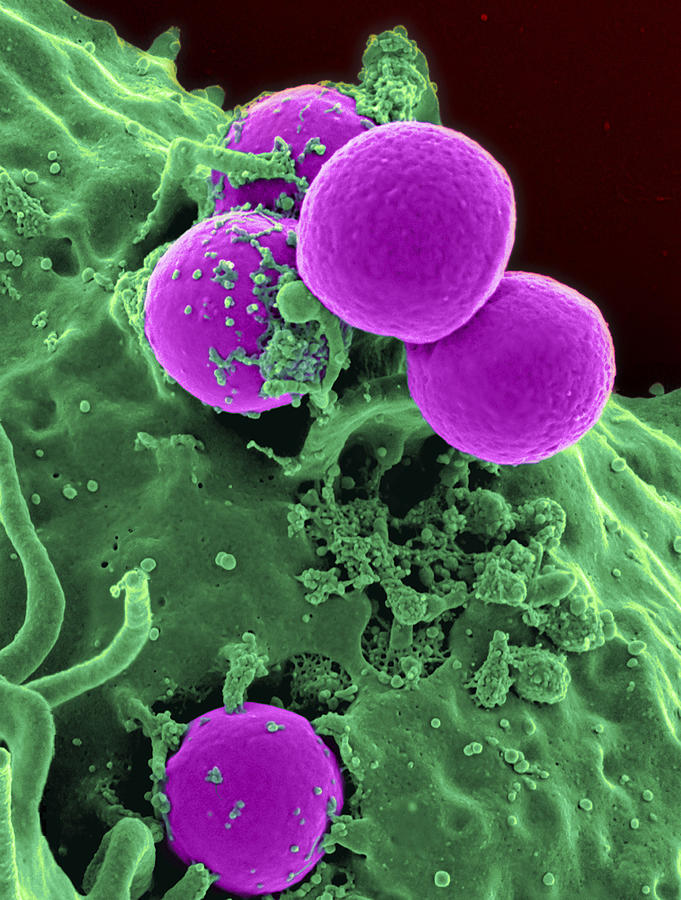 Scanning electron micrograph of a human neutrophil ingesting MRSA. Photograph by National Institutes of Health/Stocktrek Images