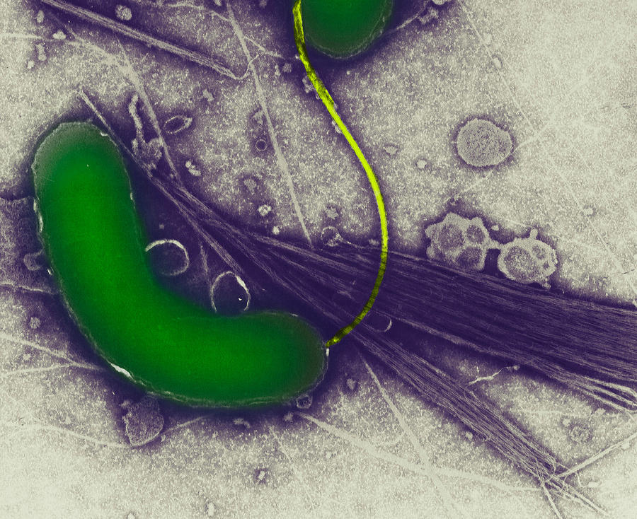 Scanning electron micrograph of Cholera bacteria Photograph by Callista Images