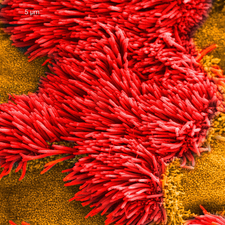 Scanning electron micrograph of lung trachea Photograph by Callista Images
