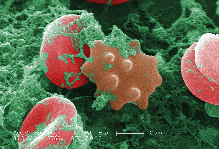 SEM of red blood cells Photograph by Callista Images